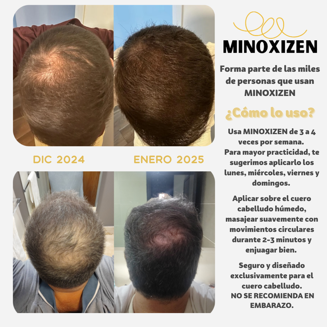 Minoxizen - Shampoo con Minoxidil, Biotina & Bergamota